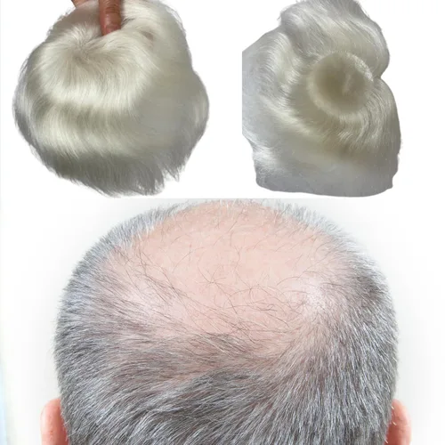 Vista 10 de Voloria Parche para el cabello calvo para hombres, 3.15 x 3.15 pulgadas, sistema de reemplazo de cobertura completa de piel de poliuretano