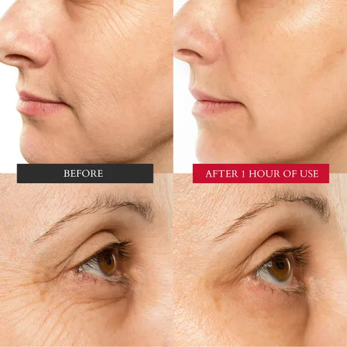 Vista 6 de Crema hidratante curativa Chuda para la piel, intensiva, para el envejecimiento de la piel, facial diario para piel seca y sensible, crema facial