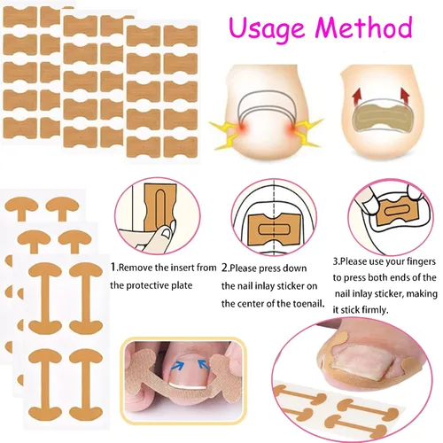 Vista 5 de Kit corrector de uñas encarnadas con tiras de corrección flexibles y cinta – Juego de herramientas profesionales de pedicura en el hogar