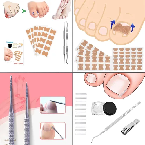 Vista 5 de Kit de tratamiento de uñas encarnadas – 16 piezas corrector profesional de uñas encarnadas con tiras, parches y almohadillas – Herramienta