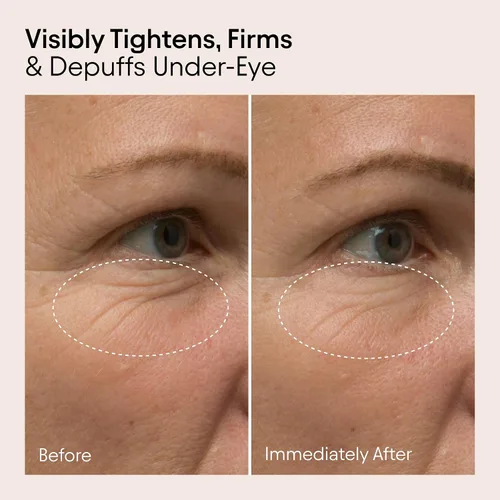 Vista 3 de Alpyn Line - Bálsamo para ojos con Bakuchiol y cafeína, reduce el aspecto de líneas finas y arrugas, minimiza la apariencia de hinchazón y ojeras