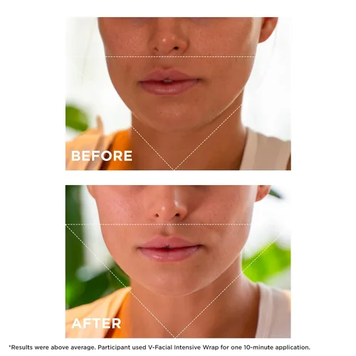 Vista 5 de Clarins Máscara facial intensiva V-Facial Mascarilla de contorno facial galardonada Reduce visiblemente la hinchazón y la hinchazón causadas por