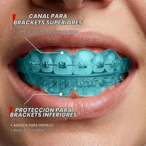Vista 3 de SafeGrin Protector Bucal Azul para Brackets para Deportes - Silicona Premium para Adolescentes y Jóvenes, Protección de Dientes Superiores e