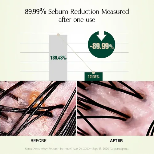 Vista 6 de Champú reequilibrante con solución de cuero cabelludo, limpieza refrescante y refrescante para cuero cabelludo normal a graso, dermatológicamente