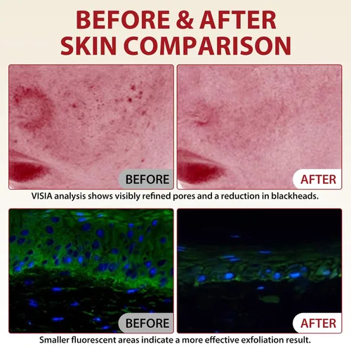 Vista 7 de Paquete de 2 ampollas de arroz Peel Shot Glow Dúo, exfoliante de arroz blanco y negro para todo tipo de piel, minimizador hidratante de poros