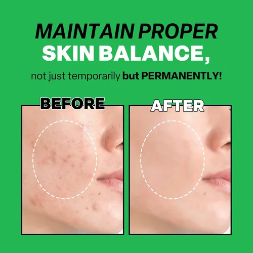 Vista 5 de Troubless Mild Clear Toner Essence - Tónico facial de árbol de té para todo tipo de piel, tónico hidratante para la piel, cuidado diario de la piel