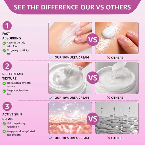Vista 5 de Crema 10% de urea con aloe vera, aceite de jojoba y ácido salicílico, 5.1 fl oz hidratante para manos, pies, cara y cuerpo secas y agrietadas
