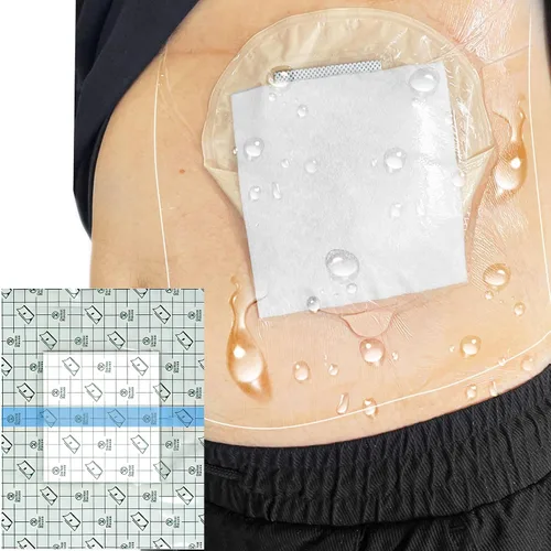 Vista 10 de Funda de ducha de ostomía impermeable de 6 x 6 pulgadas (paquete de 25), bolsa de ostomía, protector de ducha, protector de ducha de estomía