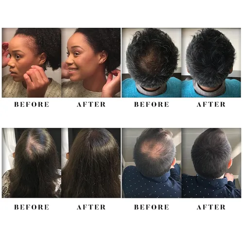 Vista 5 de Alfy Kit de iniciación – Fibras capilares para adelgazar el cabello – Fibras de queratina de primera calidad para hombres y mujeres – Fibras Marrón