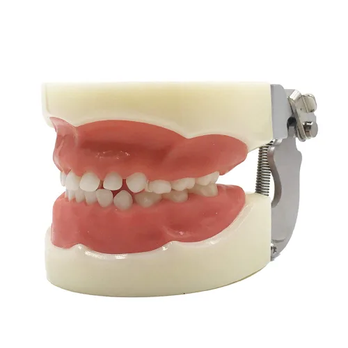 Vista 2 de Typodont - Modelo de dientes para niños, con 24 dientes extraíbles, compatible con Kilgore Nissin para enseñanza, estudio