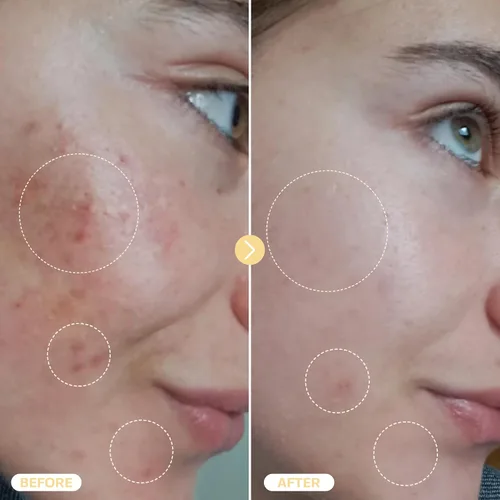 Vista 6 de BASE LABORATORIES Spray de Ácido Hipocloroso para Cara y Piel - Tamaño de Viaje - Spray Tónico Facial y Limpiador - Solución de Reparación
