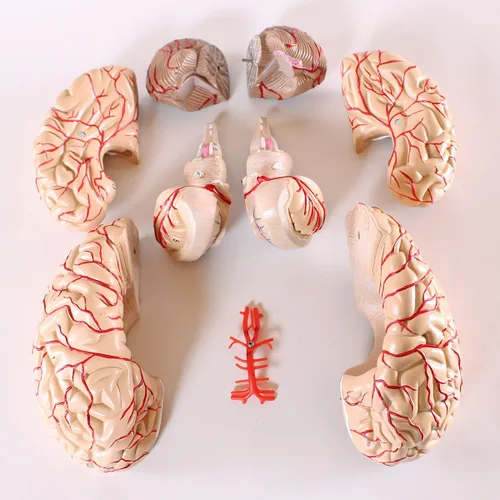Vista 2 de Wellden Modelo anatómico de cerebro, de 9 partes, con arterias, tamaño real.