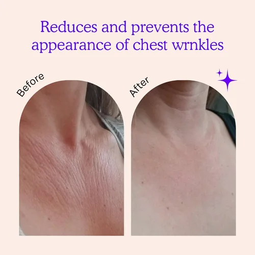 Vista 2 de BLUMBODY Almohadillas antiarrugas para el pecho y el cuello – Parches de silicona antiarrugas para la piel, reafirmantes y suavizantes – Almohadilla