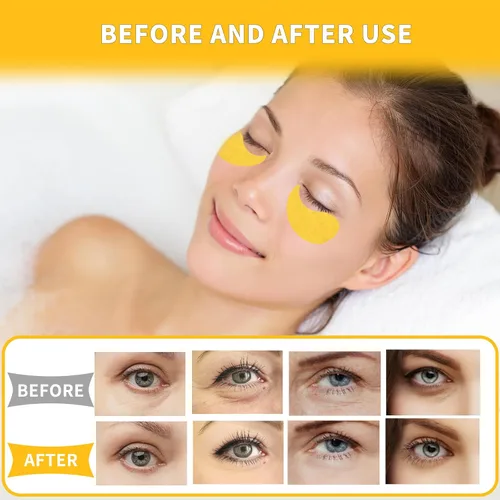 Vista 6 de Qyiywim Parches para debajo de los ojos 70 PCS, parches de oro de 24 quilates para tratamiento de ojos hinchados, máscaras debajo de los ojos