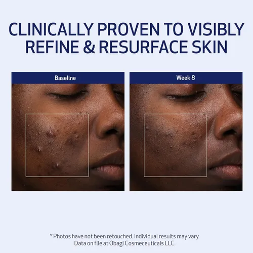 Vista 8 de Obagi Medical Retinol + PHA Refining Night Cream - Clínicamente probada, de doble acción, crema facial antienvejecimiento durante la noche para una