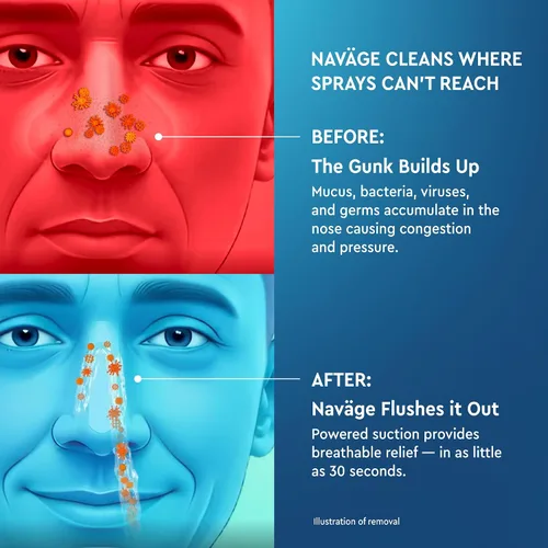Vista 9 de Navage Paquete de Viaje - Sistema de Irrigación Nasal - Kit de Enjuague Nasal Salino con 1 Limpiador de Nariz, 30 Cápsulas de Sal y Bolsa de Viaje