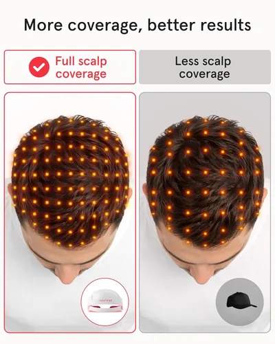 Vista 6 de iRestore Sistema de crecimiento del cabello con láser esencial: tratamientos de pérdida de cabello aprobados por la FDA para hombres y mujeres
