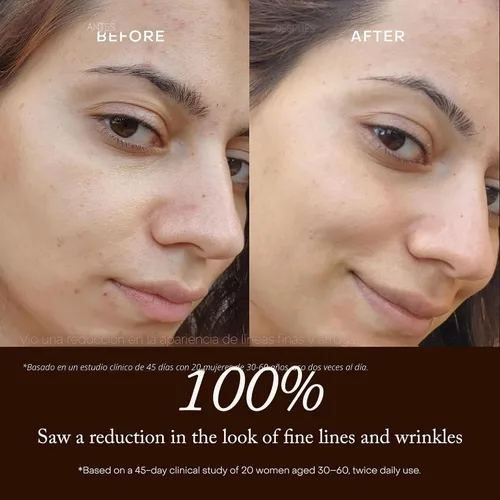Vista 4 de True Botanicals Renew Pure Radiance Oil Aceite facial antienvejecimiento con rosa mosqueta Reduce la apariencia de líneas finas y arrugas