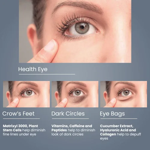 Vista 5 de Crema anti envejecimiento para ojos, para reducir ojeras, hinchazón, bolsas en los ojos, patas de gallo, líneas finas y flacidez en solo 6 semanas.