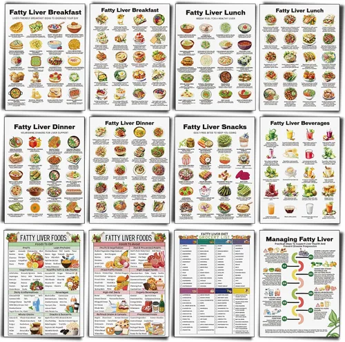 Vista 9 de Sinload 12 piezas de póster de dieta de alimentos para reflujo ácido, lista de dieta para ERGE, alimentos bajos en ácido, lista de compras