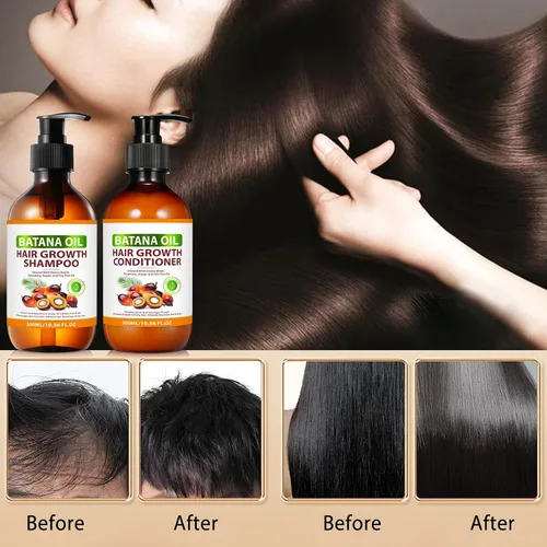Vista 9 de Batana Oil - Juego de champú y acondicionador orgánico Batana con cebolla, romero, árbol de té de argán, productos para el cabello espesante