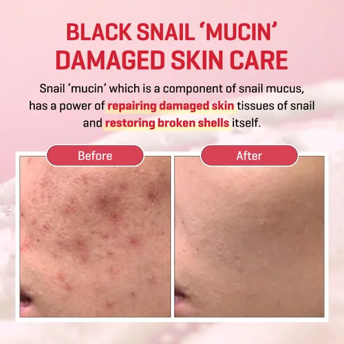 Vista 4 de SOME BY MI Snail Trucica Miracle Repair Serum - 1.69 onzas, 1.7 fl oz - Hecho de mucina de caracol para piel sensible - Suero facial de reparación