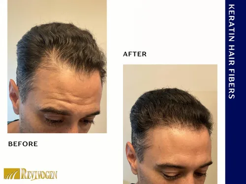 Vista 7 de RevivogenMD - Fibras de queratina para el cabello, color negro, sin perfume, 0.9 onzas
