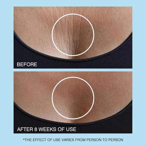 Vista 7 de UJhay Crema de Cuello con Retinol, Crema Reafirmante Enriquecida con Ácido Hialurónico y Cafeína para Minimizar Líneas Finas y Opacidad - Crema