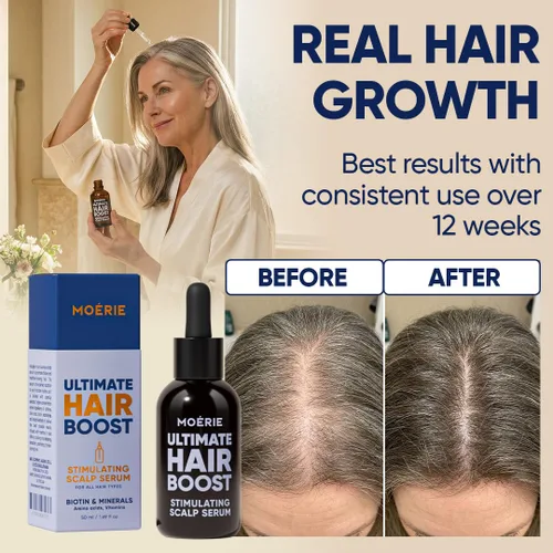 Vista 4 de Moerie Suero para el Crecimiento del Cabello Ultimate para el Crecimiento Natural del Cabello y Engrosamiento - Tratamiento Anti Adelgazamiento