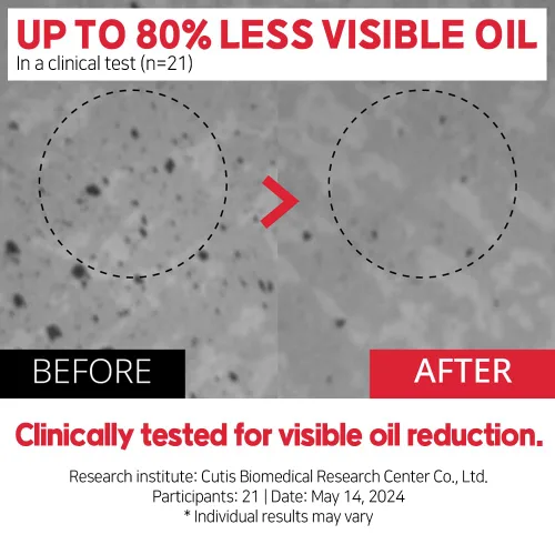 Vista 6 de ATOMU Oil Control Limpiador facial espumoso para piel grasa y poros obstruidos, lavado facial de limpieza profunda con ácido salicílico (BHA), 4.05