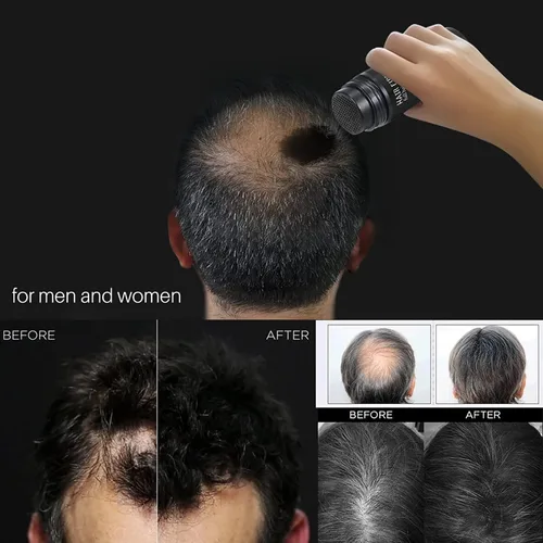 Vista 3 de RoseFlower Fibras capilares para cabello adelgazante, unisex, impermeables, indetectables al instante, ocultan las áreas de cabello calvo y #2