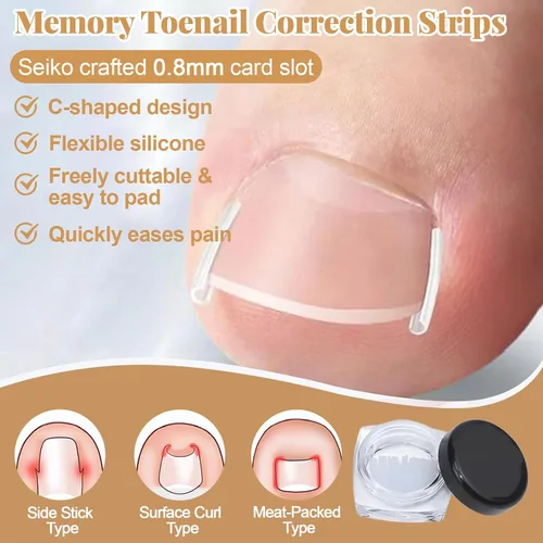 Vista 5 de Kit de eliminación y corrector de uñas encarnadas para un alivio rápido del dolor, kit profesional de tratamiento de uñas encarnadas con tiras