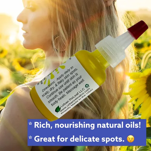 Vista 3 de Urban ReLeaf Tratamiento de manchas de piel escamosa. Aceite reparador suavizante de la piel, alivio natural para manchas escamosas, agrietadas