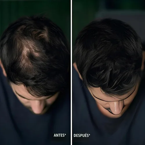 Vista 9 de Polvo de línea capilar para retoque de raíz negra, corrector de pérdida de cabello instantánea para cabello delgado, resistente al viento y al