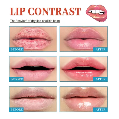 Vista 4 de Labios secos y agrietados, bálsamo labial curativo natural, crema orgánica para tratamiento de queilitis humectante durante todo el día, hombres