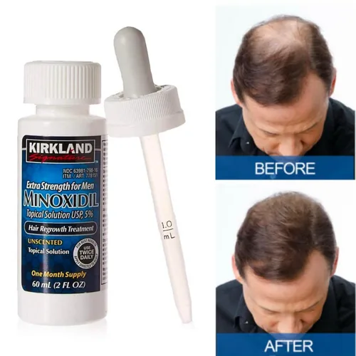 Vista 9 de Minoxidil - Solución tópica al 5% para hombres, tratamiento extra fuerte para el crecimiento del cabello, aplicador con cuentagotas incluido