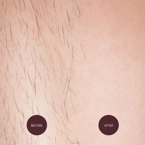 Vista 4 de Nad's Crema depilatoria - Depilación suave y calmante para mujeres - Crema depilatoria sensible para cuerpo y piernas, 5.1 onzas