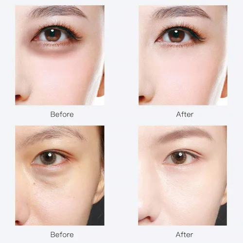 Vista 5 de Parches para debajo de los ojos, 30 pares de antienvejecimiento de ácido hialurónico, almohadillas de gel de colágeno para ojeras, arrugas, línea