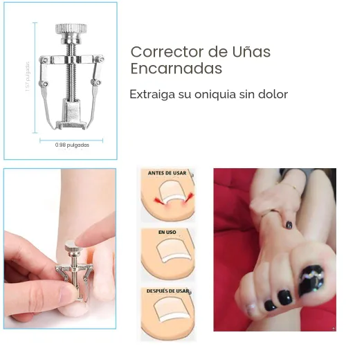 Vista 6 de Bcabo Kit de herramientas de uñas encarnadas, herramienta de pie de tratamiento de uñas, cortaúñas encarnadas, cortaúñas encarnadas, levantador
