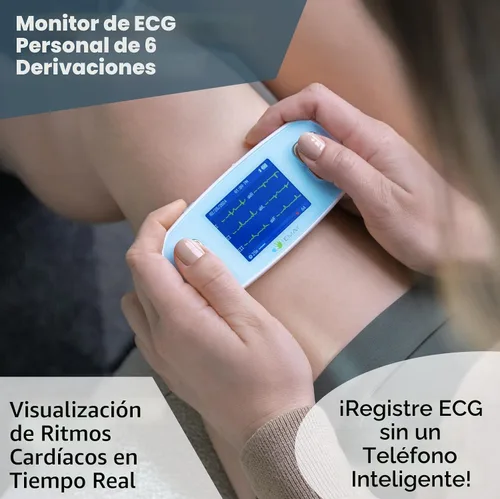 Vista 2 de EMAY 6L Monitor ECG portátil Graba ECG y frecuencia cardíaca en 6 canales Compatible con Smartphone y PC No se requiere suscripción