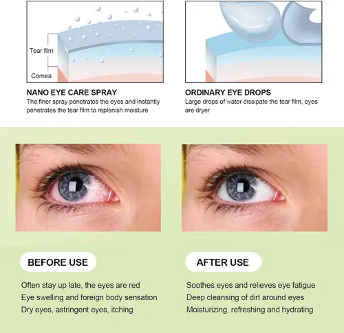 Vista 9 de Humidificador y vaporizador portátil para ojos secos, pulverizador de niebla para hidratar, vapor rápido, maquillaje (azul)