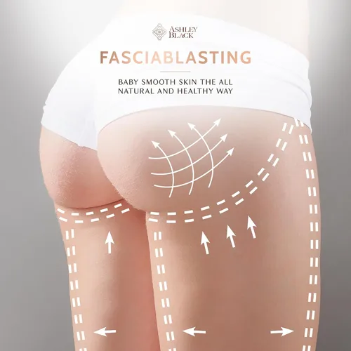 Vista 8 de Fasciablaster