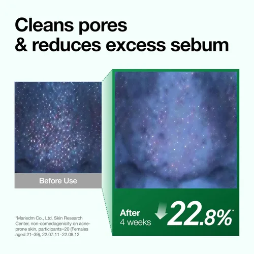 Vista 6 de Anua Heartleaf Aceite limpiador de control de poros, limpiador de poros, cuidado de sebo, limpiador suave de aceite de fusión para cara, seguro