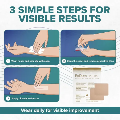 Vista 8 de EpiDerm - Hojas pequeñas de silicona para cicatrices, reutilizables, 2 x 2.5 pulgadas, 1 par, natural Soft Flexible Silicone Scar Patches for