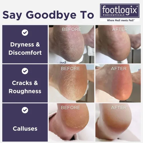 Vista 2 de FOOTLOGIX Lima de doble cara con mango de goma