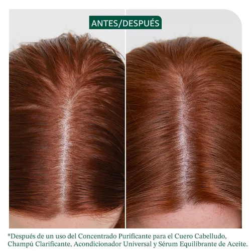Vista 2 de Biolage Scalp Sync Clarifying Shampoo - Residue & Buildup Remover, For Oily Scalp