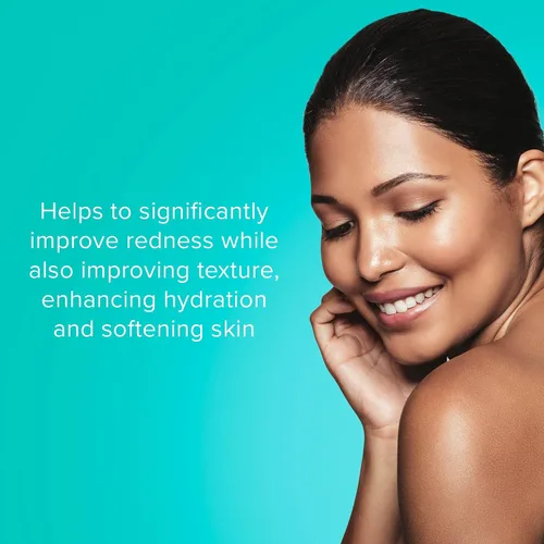 Vista 2 de ClarityRx Take It Easy - Suero facial calmante, tratamiento natural antienrojecimiento a base de plantas para pieles sensibles y rosácea