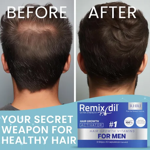 Vista 7 de Vitaminas para el crecimiento del cabello para hombres Apoya la fuerza de la barba y el cuero cabelludo Ayuda a reducir el adelgazamiento