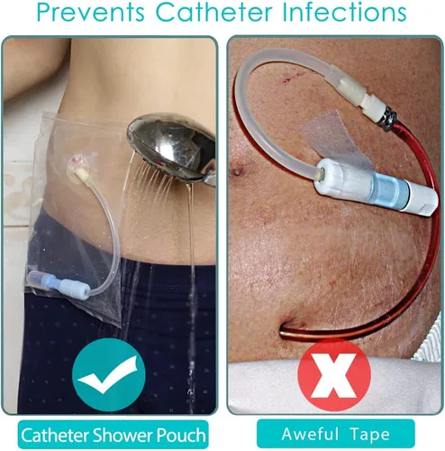 Vista 4 de Bolsa de ducha de diálisis peritoneal, impermeable, protector de puerto PD, funda desechable para transferencia, soporte de catéter, clavija