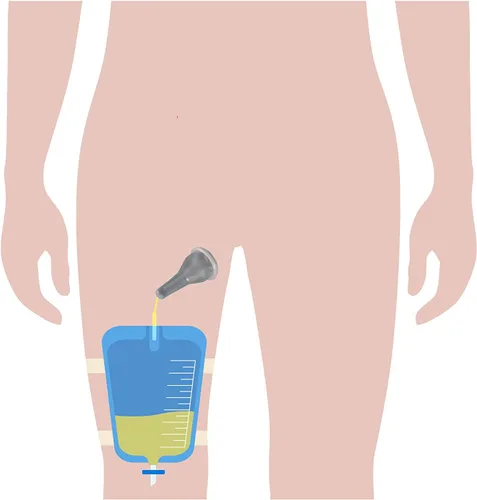 Vista 2 de Kit completo urinario 5 días 5 catéteres de condón externos auto-marino + bolsa para piernas de 25.4 fl oz + correas con un tubo de 5.9 pulgadas 5.9